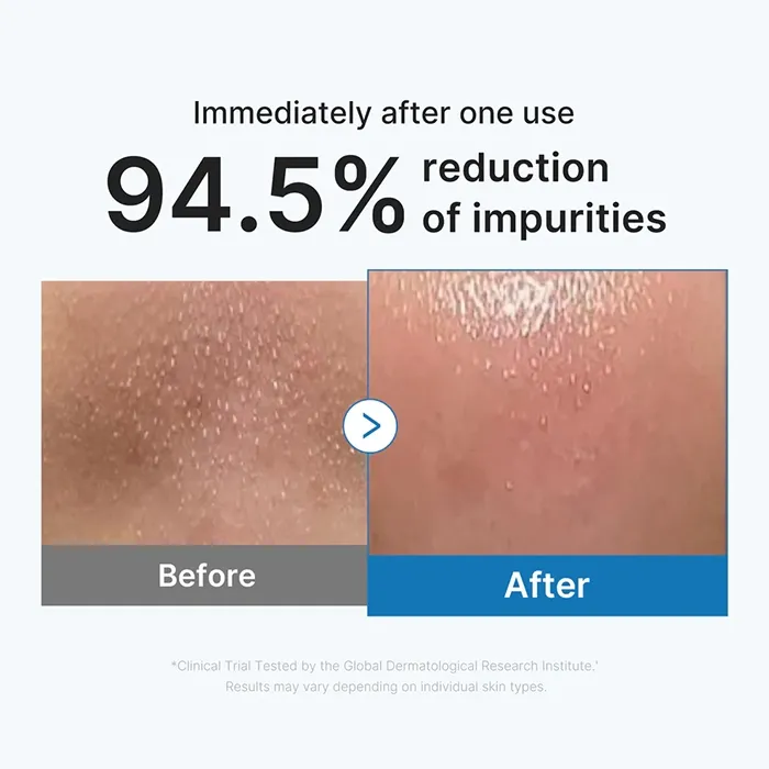 Miniature 2 de Medicube Zero Pore Blackhead Deep Cleansing Oil
